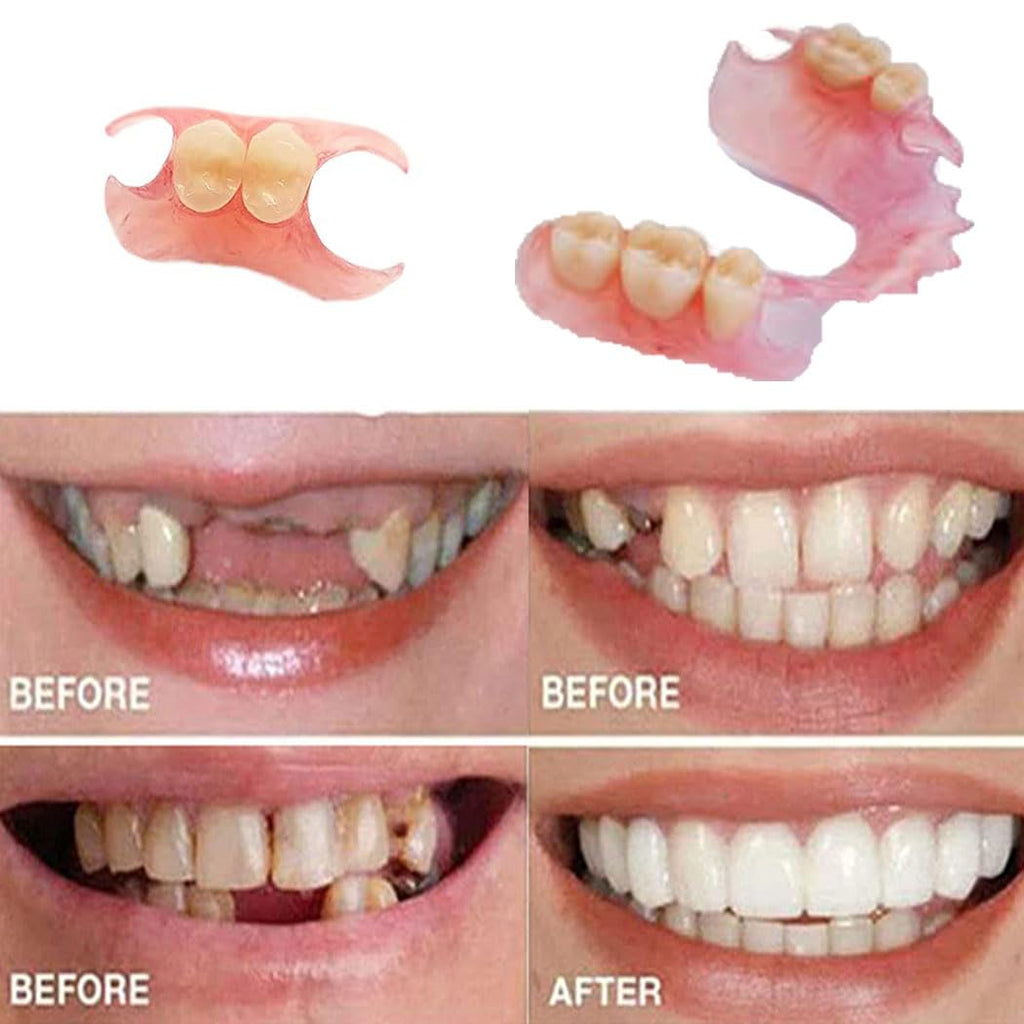 Fake Tooth Repair Kit V19048